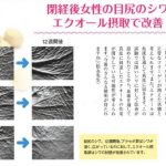 エクオールの凄さと実体験