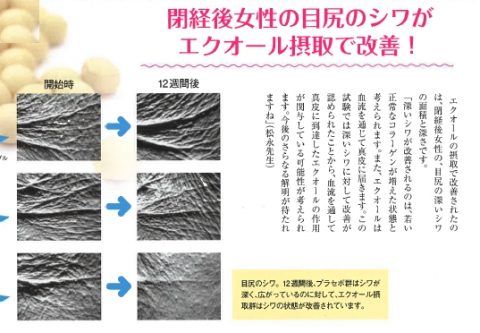 エクオール